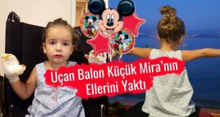 Uçan Balon Küçük Kızın Ellerini Yaktı