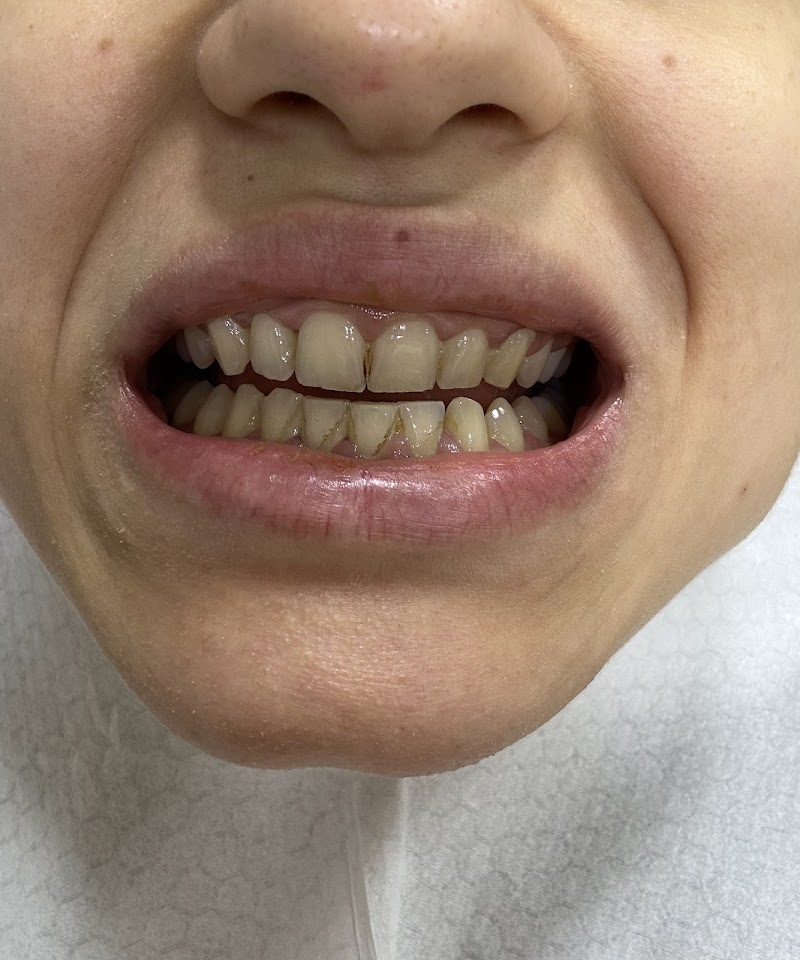 Özel Egem Ağız ve Diş Sağlığı Polikliniği – Gemlik